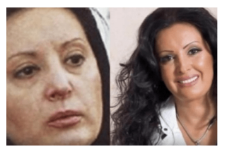 “Ni ona sada nije odolila trendu vjecne mladosti: Draga Dragana sto ti je ovo trebalo- izoblicila se, vise ne lici na sebe?” “Ni ona sada nije odolila trendu vjecne mladosti: Draga Dragana sto ti je ovo trebalo- izoblicila se, vise ne lici na sebe?”