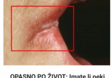 OPASNO PO ŽIVOT: Imate li neki od OVIH simptoma Nagovještavaju nešto loše!