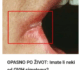 OPASNO PO ŽIVOT: Imate li neki od OVIH simptoma Nagovještavaju nešto loše!
