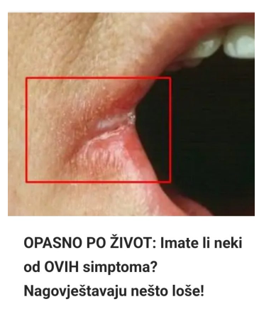 OPASNO PO ŽIVOT: Imate li neki od OVIH simptoma Nagovještavaju nešto loše!