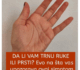 Osjećate li trnce u rukama ili prstima Ovaj simptom služi kao važan znak upozorenja koji se ne smije zanemariti