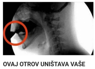 OVAJ OTROV UNIŠTAVA VAŠE KOSTI: Većina ga konzumira barem jednom dnevno OVAJ OTROV UNIŠTAVA VAŠE KOSTI: Većina ga konzumira barem jednom dnevno