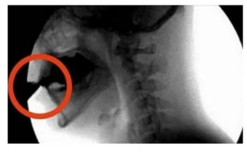 OVAJ OTROV UNIŠTAVA VAŠE KOSTI: Većina ga konzumira barem jednom dnevno OVAJ OTROV UNIŠTAVA VAŠE KOSTI: Većina ga konzumira barem jednom dnevno
