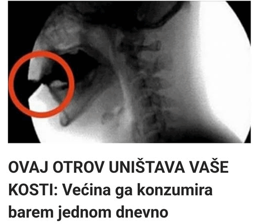 OVAJ OTROV UNIŠTAVA VAŠE KOSTI: Većina ga konzumira barem jednom dnevno