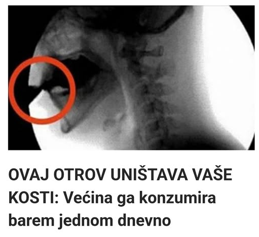OVAJ OTROV UNIŠTAVA VAŠE KOSTI: Većina ga konzumira barem jednom dnevno