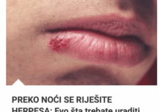 PREKO NOĆI SE RIJEŠITE HERPESA: Evo šta trebate uraditi da nestane