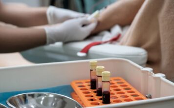 Tihi poremećaj koji imitira depresiju – kako ga razlikovati i liječiti? Tihi poremećaj koji imitira depresiju – kako ga razlikovati i liječiti?