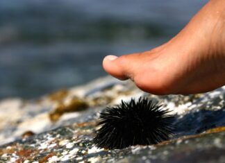 Ubod morskog ježa može da dovede do prestanka disanja, pa čak i smrti Ubod morskog ježa može da dovede do prestanka disanja, pa čak i smrti
