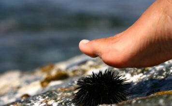 Ubod morskog ježa može da dovede do prestanka disanja, pa čak i smrti Ubod morskog ježa može da dovede do prestanka disanja, pa čak i smrti