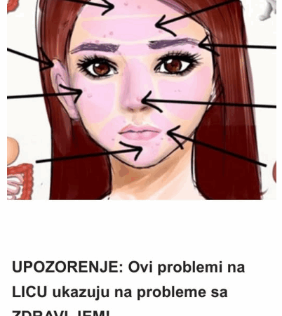 UPOZORENJE: Ovi problemi na LICU ukazuju na probleme sa ZDRAVLJEM!