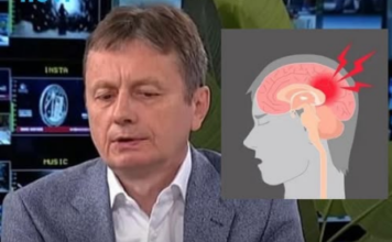 Jedan simptom MOŽDANOG UDARA je važan i može vam spasiti život Jedan simptom MOŽDANOG UDARA je važan i može vam spasiti život