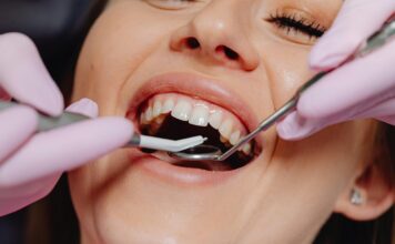 Pubertet i zdravlje zuba: Najosjetljiviji period za usnu šupljinu Pubertet i zdravlje zuba: Najosjetljiviji period za usnu šupljinu