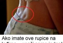 Ako imate ove rupice na leđima – znači samo jedno! Evo šta vam tijelo poručuje! Ako imate ove rupice na leđima – znači samo jedno! Evo šta vam tijelo poručuje!
