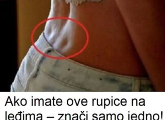 Ako imate ove rupice na leđima – znači samo jedno! Evo šta vam tijelo poručuje! Ako imate ove rupice na leđima – znači samo jedno! Evo šta vam tijelo poručuje!