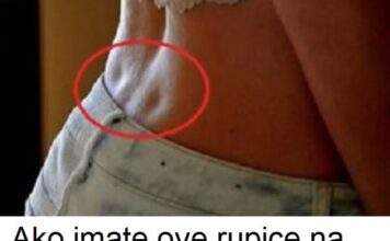 Ako imate ove rupice na leđima – znači samo jedno! Evo šta vam tijelo poručuje! Ako imate ove rupice na leđima – znači samo jedno! Evo šta vam tijelo poručuje!