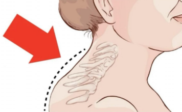 Kiropraktičar je pokazao 3 jednostavne vježbe koje će vam pomoći da ukl0nite “Grbu” u vratu: 0vo mi je najviše pomoglo! VIDEO Kiropraktičar je pokazao 3 jednostavne vježbe koje će vam pomoći da ukl0nite “Grbu” u vratu: 0vo mi je najviše pomoglo! VIDEO