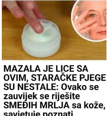 MAZALA JE LICE SA OVIM, STARAČKE PJEGE SU NESTALE: Ovako se zauvijek riješite SMEĐIH MRLJA sa kože, savjetuje poznati dermatolog MAZALA JE LICE SA OVIM, STARAČKE PJEGE SU NESTALE: Ovako se zauvijek riješite SMEĐIH MRLJA sa kože, savjetuje poznati dermatolog