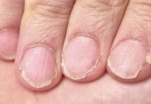 MUČE VAS UMOR, TANKA KOSA I LOMLJIVI NOKTI, EVO ŠTA VAM NEDOSTAJE U ISHRANI MUČE VAS UMOR, TANKA KOSA I LOMLJIVI NOKTI, EVO ŠTA VAM NEDOSTAJE U ISHRANI