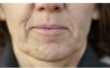 Simptom DEMENCIJE koji se javlja u ustima: Ako ga osjetite, obratite se ljekaru! Simptom DEMENCIJE koji se javlja u ustima: Ako ga osjetite, obratite se ljekaru!