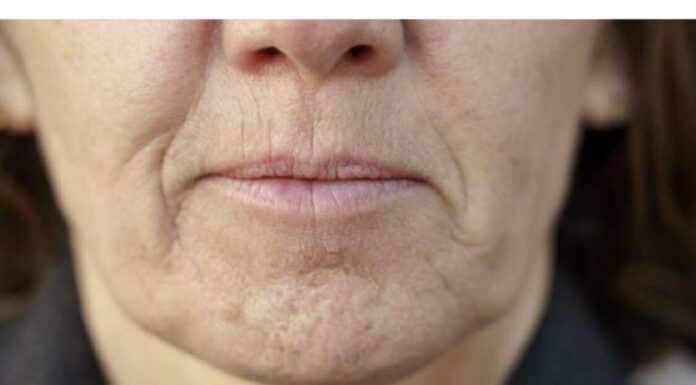 Simptom DEMENCIJE koji se javlja u ustima: Ako ga osjetite, obratite se ljekaru! Simptom DEMENCIJE koji se javlja u ustima: Ako ga osjetite, obratite se ljekaru!