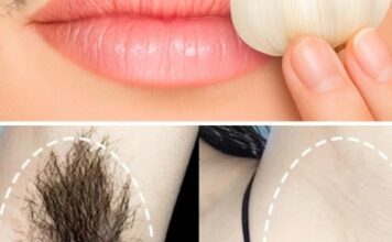Zaboravite na brijače – isprobajte ovaj prirodni trik za trajno uklanjanje dlačica Zaboravite na brijače – isprobajte ovaj prirodni trik za trajno uklanjanje dlačica