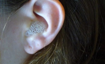 AKO VAS MUČI ZAČEPLJENO UHO, evo kako ga odčepiti prirodnim putem i bez puno boli GENIJALAN SAVJET AKO VAS MUČI ZAČEPLJENO UHO, evo kako ga odčepiti prirodnim putem i bez puno boli GENIJALAN SAVJET