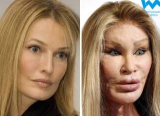 Nekad najlepša plavuša proćerdala je milijarde da bi uništila lice plastičnim operacijama: Izgledom uterivala strah u kosti i umrla neprepoznatljiva Nekad najlepša plavuša proćerdala je milijarde da bi uništila lice plastičnim operacijama: Izgledom uterivala strah u kosti i umrla neprepoznatljiva