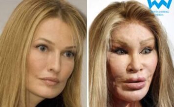 Nekad najlepša plavuša proćerdala je milijarde da bi uništila lice plastičnim operacijama: Izgledom uterivala strah u kosti i umrla neprepoznatljiva Nekad najlepša plavuša proćerdala je milijarde da bi uništila lice plastičnim operacijama: Izgledom uterivala strah u kosti i umrla neprepoznatljiva