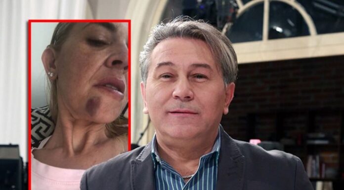 Oglasila se žena koju je Halid Muslimović pretukao: Vidjela sam da mu je crno pred očima Oglasila se žena koju je Halid Muslimović pretukao: Vidjela sam da mu je crno pred očima