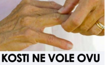 Ova hrana je štetna za zdravlje kostiju; Konzumacija može pogoršati bol, ubrzati napredovanje artritisa i dovesti do daljnjeg propadanja zglobova Ova hrana je štetna za zdravlje kostiju; Konzumacija može pogoršati bol, ubrzati napredovanje artritisa i dovesti do daljnjeg propadanja zglobova