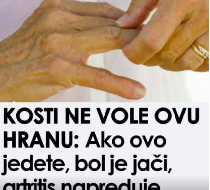 Ova hrana je štetna za zdravlje kostiju; Konzumacija može pogoršati bol, ubrzati napredovanje artritisa i dovesti do daljnjeg propadanja zglobova Ova hrana je štetna za zdravlje kostiju; Konzumacija može pogoršati bol, ubrzati napredovanje artritisa i dovesti do daljnjeg propadanja zglobova