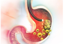 5 ranih simptoma raka želuca: Tumor može da raste godinama, a svi pacijenti prvo osjete ovo 5 ranih simptoma raka želuca: Tumor može da raste godinama, a svi pacijenti prvo osjete ovo