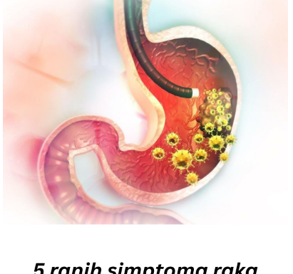 5 ranih simptoma raka želuca: Tumor može da raste godinama, a svi pacijenti prvo osjete ovo 5 ranih simptoma raka želuca: Tumor može da raste godinama, a svi pacijenti prvo osjete ovo