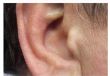 KAKO SIGURNO UKLONITI UŠNI VOSAK: METODE PREPORUČENE OD PEDIJATRA DR. GILA KAKO SIGURNO UKLONITI UŠNI VOSAK: METODE PREPORUČENE OD PEDIJATRA DR. GILA