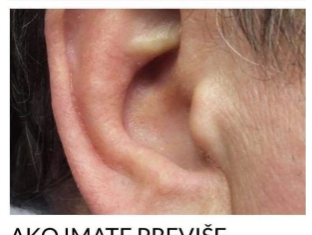 KAKO SIGURNO UKLONITI UŠNI VOSAK: METODE PREPORUČENE OD PEDIJATRA DR. GILA KAKO SIGURNO UKLONITI UŠNI VOSAK: METODE PREPORUČENE OD PEDIJATRA DR. GILA