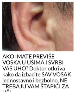 KAKO SIGURNO UKLONITI UŠNI VOSAK: METODE PREPORUČENE OD PEDIJATRA DR. GILA KAKO SIGURNO UKLONITI UŠNI VOSAK: METODE PREPORUČENE OD PEDIJATRA DR. GILA