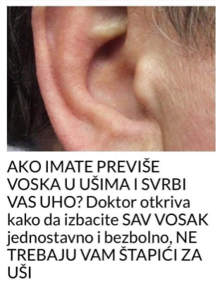 KAKO SIGURNO UKLONITI UŠNI VOSAK: METODE PREPORUČENE OD PEDIJATRA DR. GILA KAKO SIGURNO UKLONITI UŠNI VOSAK: METODE PREPORUČENE OD PEDIJATRA DR. GILA