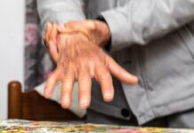 Nemački naučnici otkrili jednostavan test koji može otkriti Parkinsonovu bolest skoro 9 godina pre zvanične dijagnoze Nemački naučnici otkrili jednostavan test koji može otkriti Parkinsonovu bolest skoro 9 godina pre zvanične dijagnoze