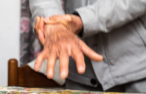 Nemački naučnici otkrili jednostavan test koji može otkriti Parkinsonovu bolest skoro 9 godina pre zvanične dijagnoze Nemački naučnici otkrili jednostavan test koji može otkriti Parkinsonovu bolest skoro 9 godina pre zvanične dijagnoze