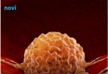 Previše ovog vitamina može povećati rizik od raka! Previše ovog vitamina može povećati rizik od raka!