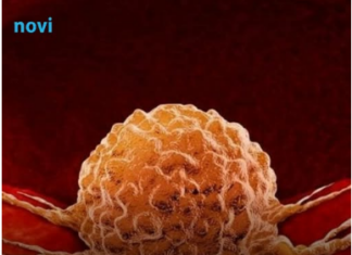 Previše ovog vitamina može povećati rizik od raka! Previše ovog vitamina može povećati rizik od raka!