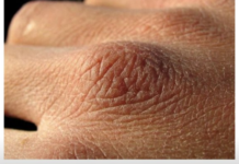 Puca vam koža, opada kosa ili imate grčeve? Tijelo vam govori da vam nedostaju ovi vitamini Puca vam koža, opada kosa ili imate grčeve? Tijelo vam govori da vam nedostaju ovi vitamini