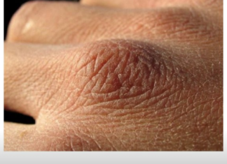 Puca vam koža, opada kosa ili imate grčeve? Tijelo vam govori da vam nedostaju ovi vitamini Puca vam koža, opada kosa ili imate grčeve? Tijelo vam govori da vam nedostaju ovi vitamini