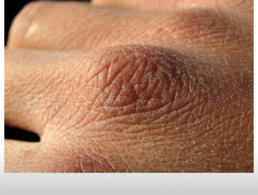 Puca vam koža, opada kosa ili imate grčeve? Tijelo vam govori da vam nedostaju ovi vitamini Puca vam koža, opada kosa ili imate grčeve? Tijelo vam govori da vam nedostaju ovi vitamini