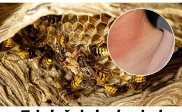 Tri slučaja kada ujed stršljena može da bude fatalan: Jedna stvar mora da se uradi ODMAH Tri slučaja kada ujed stršljena može da bude fatalan: Jedna stvar mora da se uradi ODMAH