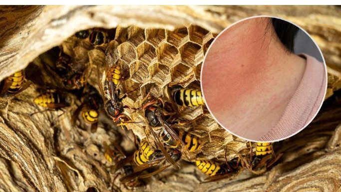 Tri slučaja kada ujed stršljena može da bude fatalan: Jedna stvar mora da se uradi ODMAH Tri slučaja kada ujed stršljena može da bude fatalan: Jedna stvar mora da se uradi ODMAH