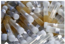 ZAŠTO IMATE JAK I NEPRIJATAN MIRIS URINA: Ovaj znak organizma ne smijete zanemariti! EVO NA ŠTA VAS UPOZORAVA ZAŠTO IMATE JAK I NEPRIJATAN MIRIS URINA: Ovaj znak organizma ne smijete zanemariti! EVO NA ŠTA VAS UPOZORAVA