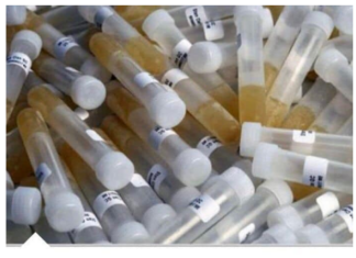 ZAŠTO IMATE JAK I NEPRIJATAN MIRIS URINA: Ovaj znak organizma ne smijete zanemariti! EVO NA ŠTA VAS UPOZORAVA ZAŠTO IMATE JAK I NEPRIJATAN MIRIS URINA: Ovaj znak organizma ne smijete zanemariti! EVO NA ŠTA VAS UPOZORAVA