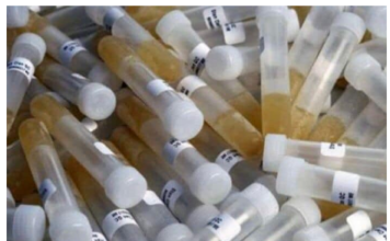 ZAŠTO IMATE JAK I NEPRIJATAN MIRIS URINA: Ovaj znak organizma ne smijete zanemariti! EVO NA ŠTA VAS UPOZORAVA ZAŠTO IMATE JAK I NEPRIJATAN MIRIS URINA: Ovaj znak organizma ne smijete zanemariti! EVO NA ŠTA VAS UPOZORAVA