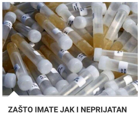 ZAŠTO IMATE JAK I NEPRIJATAN MIRIS URINA: Ovaj znak organizma ne smijete zanemariti! EVO NA ŠTA VAS UPOZORAVA ZAŠTO IMATE JAK I NEPRIJATAN MIRIS URINA: Ovaj znak organizma ne smijete zanemariti! EVO NA ŠTA VAS UPOZORAVA